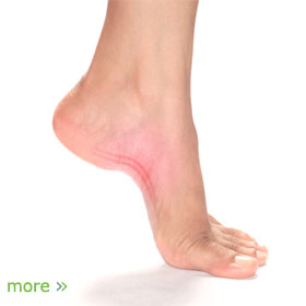 pain and swelling in heel and arch of foot