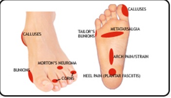 Orthotics Treatment To Help Eliminate Your Foot Pain Foot Solutions